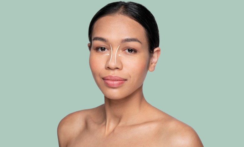 How to Plan Your Recovery After Ethnic Rhinoplasty via Open Rhinoplasty Surgery in London