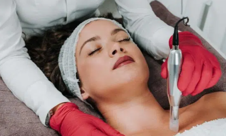How to Plan Your Skin Care Timeline Between Microneedling in Cambridge and Mole Removal